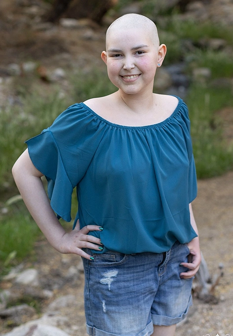 Oliva - Bald Beauty