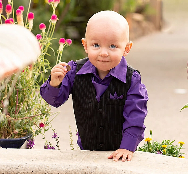Eden - Bald Beauties Project