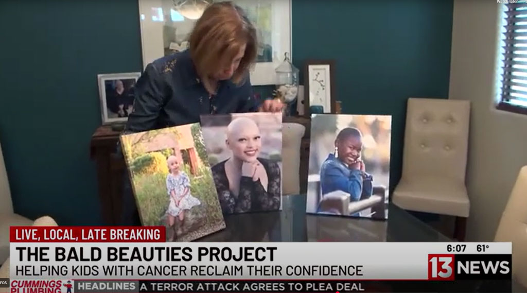 Bald Beauties Project